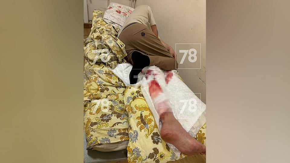 На Алтае голый мужчина рассмешил сельских полицейских В Самарской области голый пациент сбежал из клиники, откусил нос кассирше и умер