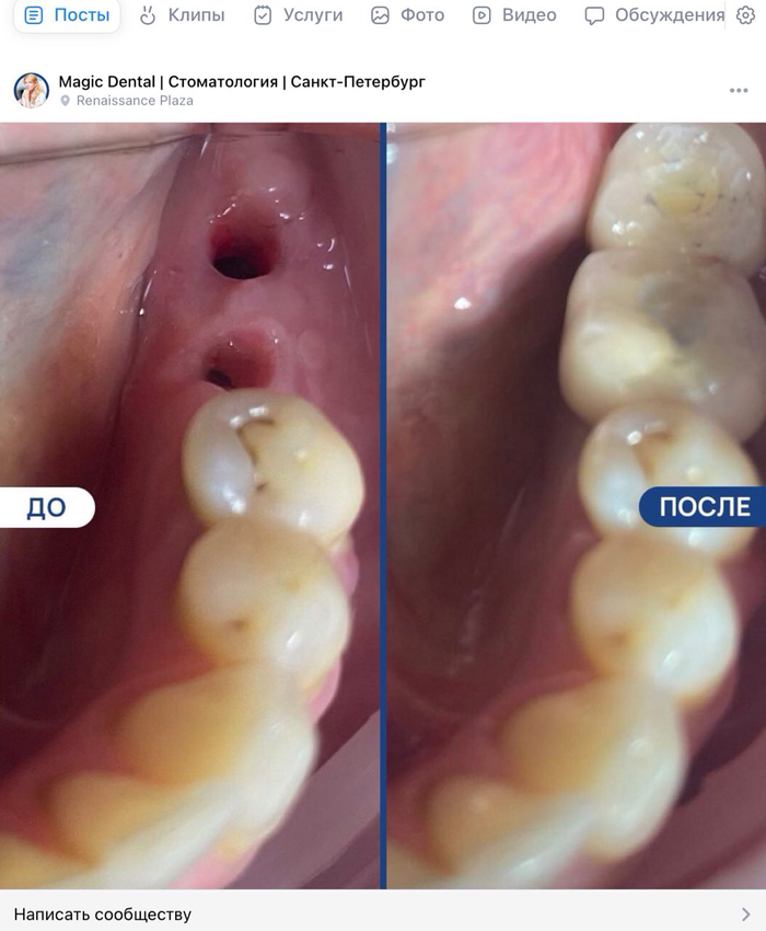 Визуал поста