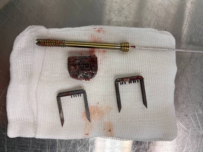 �������� �����, � ������ ������, ��� ����������� ��� �������� ��� ���������� ��������������� ��������� � �������������� ������. ������, ���� ������� �� �� ��������, � ����� ���� ������ � �������������� ���������� ����� ������.