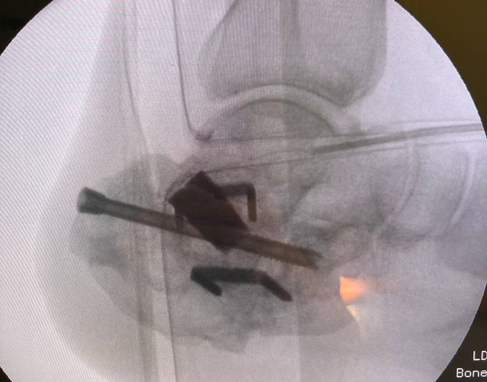 ������ � ������ �������� �������� ����������� ������, ����� �������� ������ � ���� �� ��������.