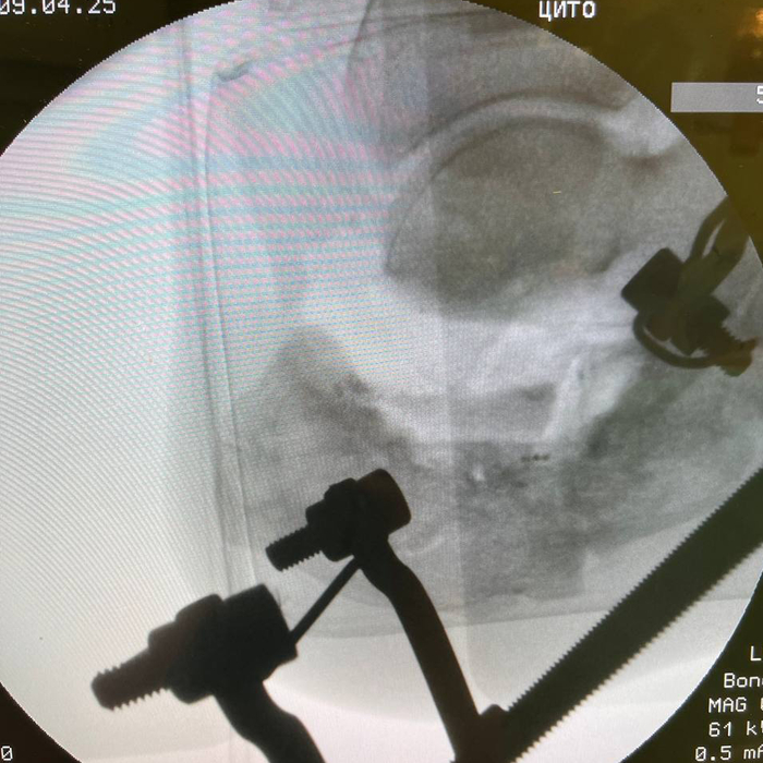 ������� ������ � ���������� ��������.