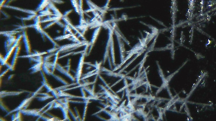 Увеличение х200. сухой, верхняя подсветка