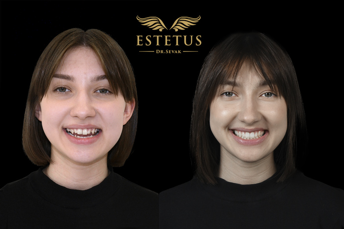 ������ ���������������� �����