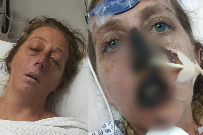 Как поиграть со зверушкой и чудом остаться вживых, правда, без рук, ног, и лица