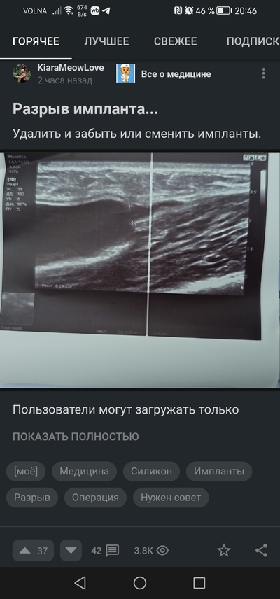 Иллюстрация к комментарию