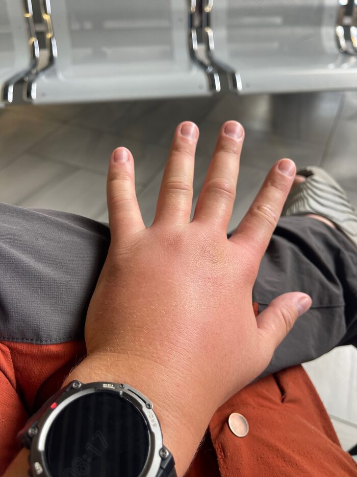 Моя рука размером с чебурек