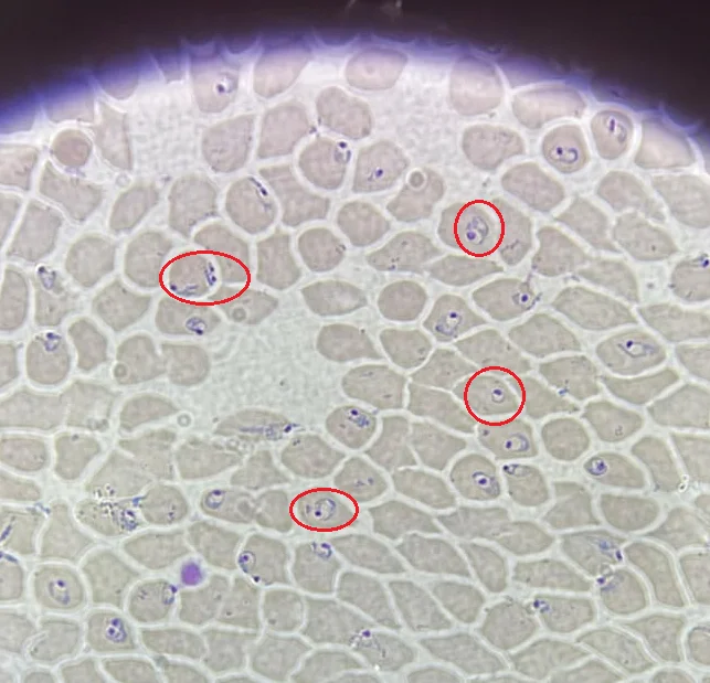 Malaria: Advice for Travellers to Endemic Areas - Series Protozoa, My, The medicine, Treatment, Malaria, Anopheles, Medications
