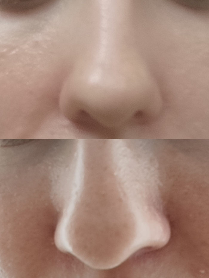 ДО/ ПОСЛЕ(ракурс немного отличается)