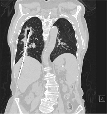 Figure 3.   -  .      18 ,      ( V  VIII)      