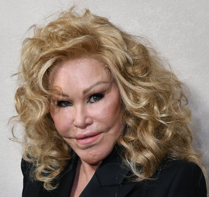 Полная деформация лица из-за множественных хирургических вмешательств, приводящая к экстремальной асимметрии и искаженным пропорциям (увеличенные щеки и глаза), полностью отклоняющимся от любых норм