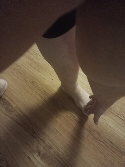 Продолжение поста «С 310 кг до 119 кг за 19 месяцев. Личный опыт» Хирургия, Лечение, Длиннопост, Ответ на пост