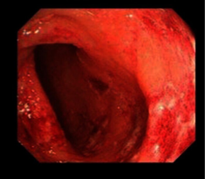 Figure 2.       ,   , ,   .