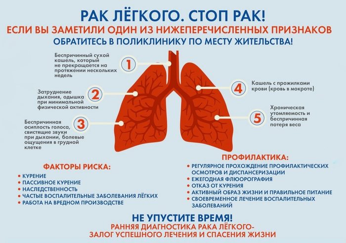 Курильщики в 20 раз чаще страдают раком лёгких