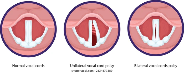 Разного рода проблемы на картинках