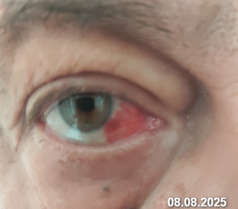 ���������� 08.08.2025