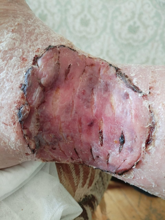 ����� �������