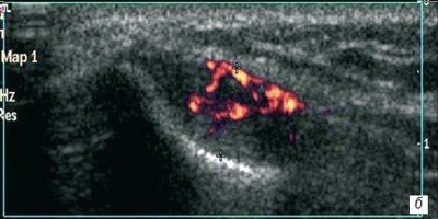 �������� ����������� ��� ���.