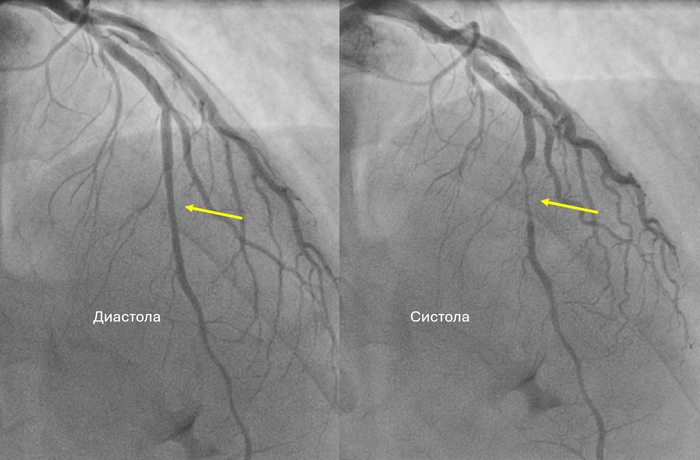 �������� ������� �������� ����.