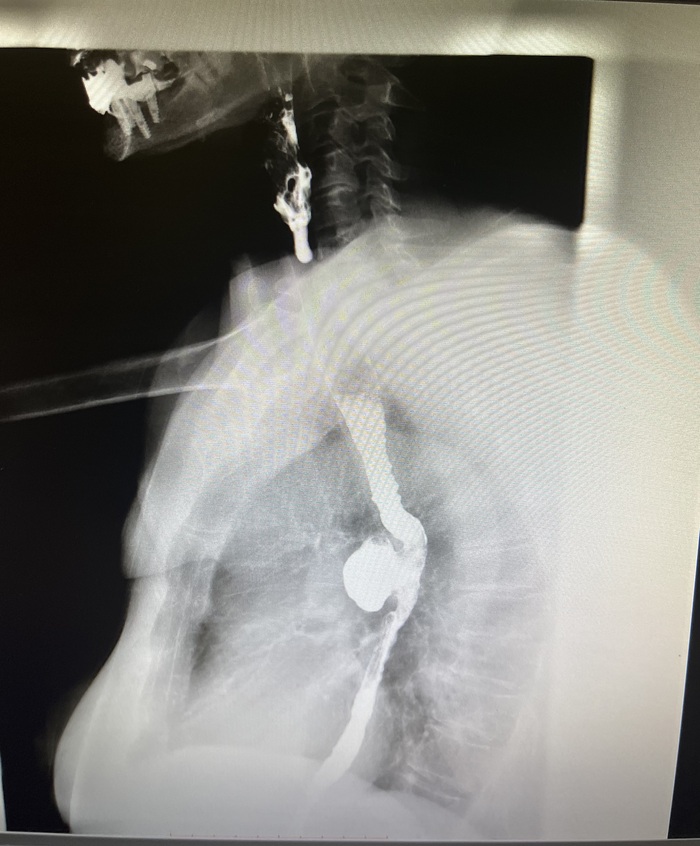 ��� ���������� ������� 1/3 �������� + ��������, ���������� ���� ��������