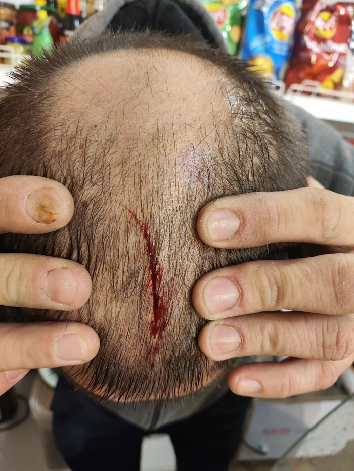 ���� �������� ����� ������