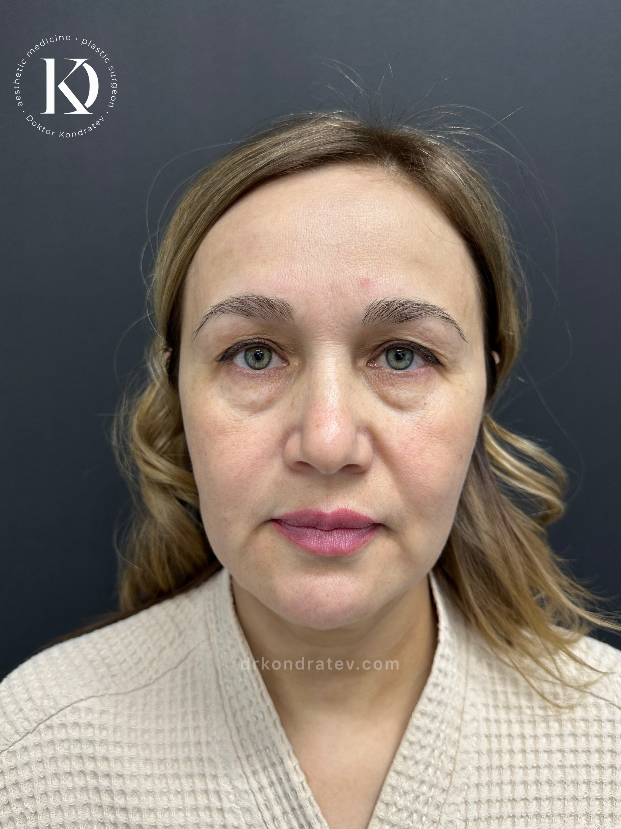 How to restore your original face without signs of overtightening? - My, Face, Facelift, Blepharoplasty, Video, Vertical video, Short videos, Longpost