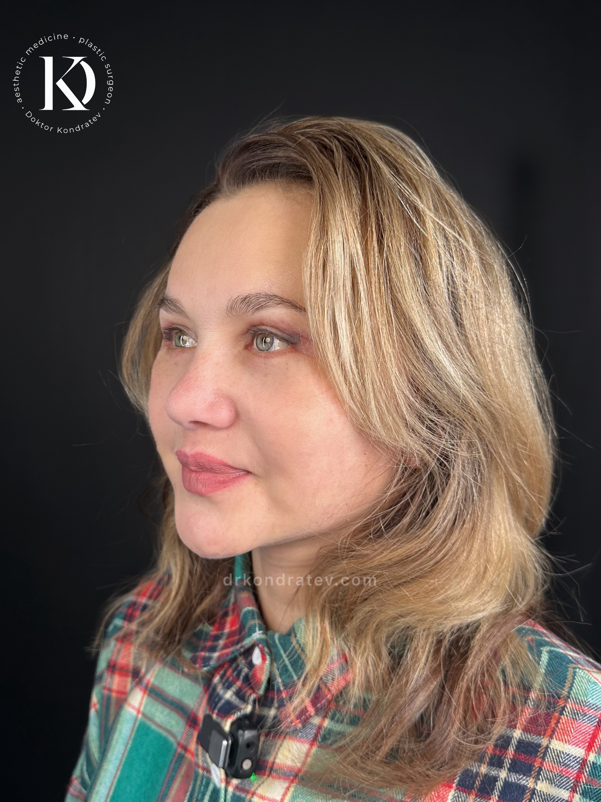 How to restore your original face without signs of overtightening? - My, Face, Facelift, Blepharoplasty, Video, Vertical video, Short videos, Longpost