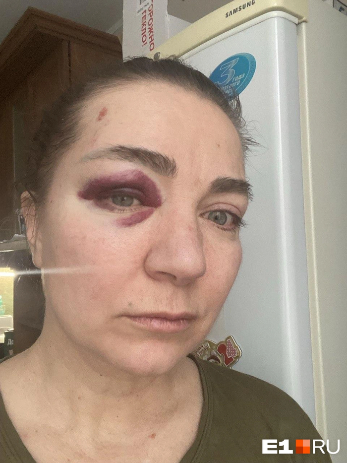 ������� �������� ������� ����������� ��������: �������� <!--noindex--><a href="https://pikabu.ru/story/ubivay_ee_zhenu_yekspolitseyskogo_zhestko_izbili_na_sortirovke_13619417?u=http%3A%2F%2FE1.RU&t=E1.RU&h=d14cb2f4849bc246a517d6332b909846dc263a36" title="http://E1.RU" target="_blank" rel="nofollow noopener">E1.RU</a><!--/noindex-->