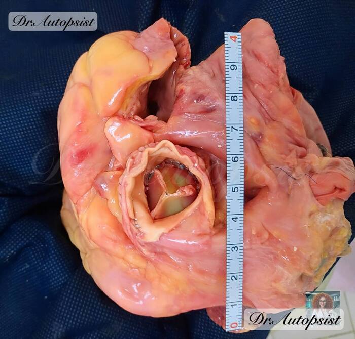 ����� ������)