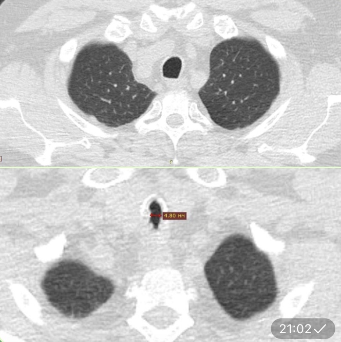 ������������ ����������. ������ ������������ ����� ������. ����� ���������� ������ ������ �� 4 ��. ���� ����� - ��������������� ������� ��������� ������� (������������). 