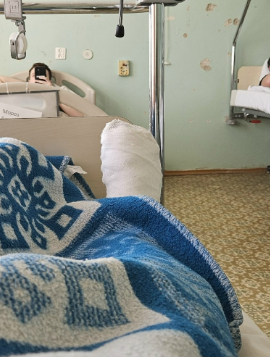 Лежу в стационаре после операции на большом пальце правой ноги