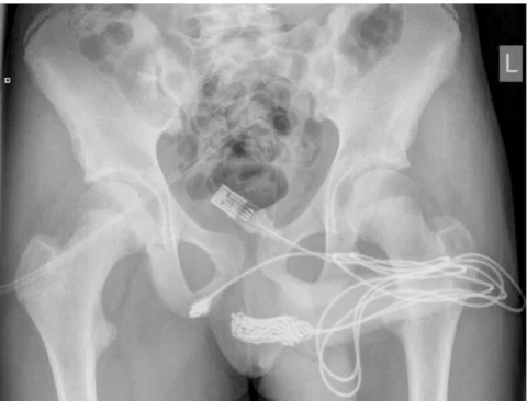 Do you want to do it like in the UK? Don't do it. - Surgery, Operation, Sexual preoccupation, Penis, 49 and 5, London, Dangerous games, news