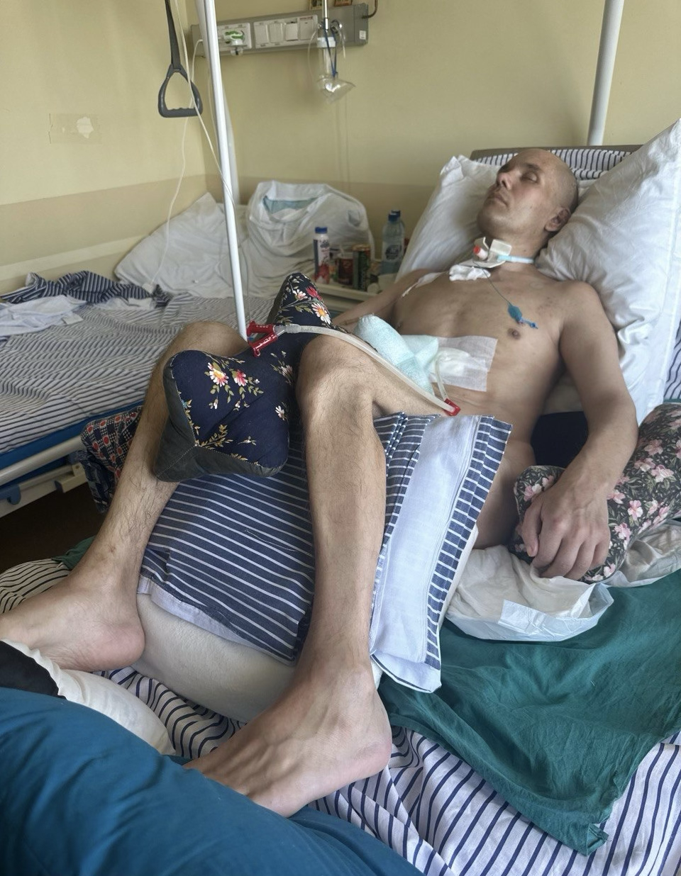 I won't give up and I won't let you or the story of the fight for my husband's life. The Wives Project - Series Project Wives, My, Longpost, Wife, Russian spirit, Regina, Disease history, Injury, Treatment, Surgery, Operation, Video, Vertical video, Short videos, Rutube
