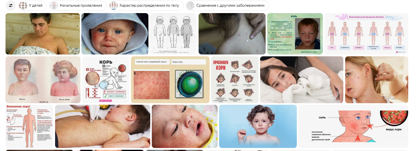 Reply to the post No, that's nonsense - Series Tyoma explains about medicine, Humor, Measles, Anti-vaccines, A wave of posts, Telegram (link), Screenshot, Reply to post, Longpost