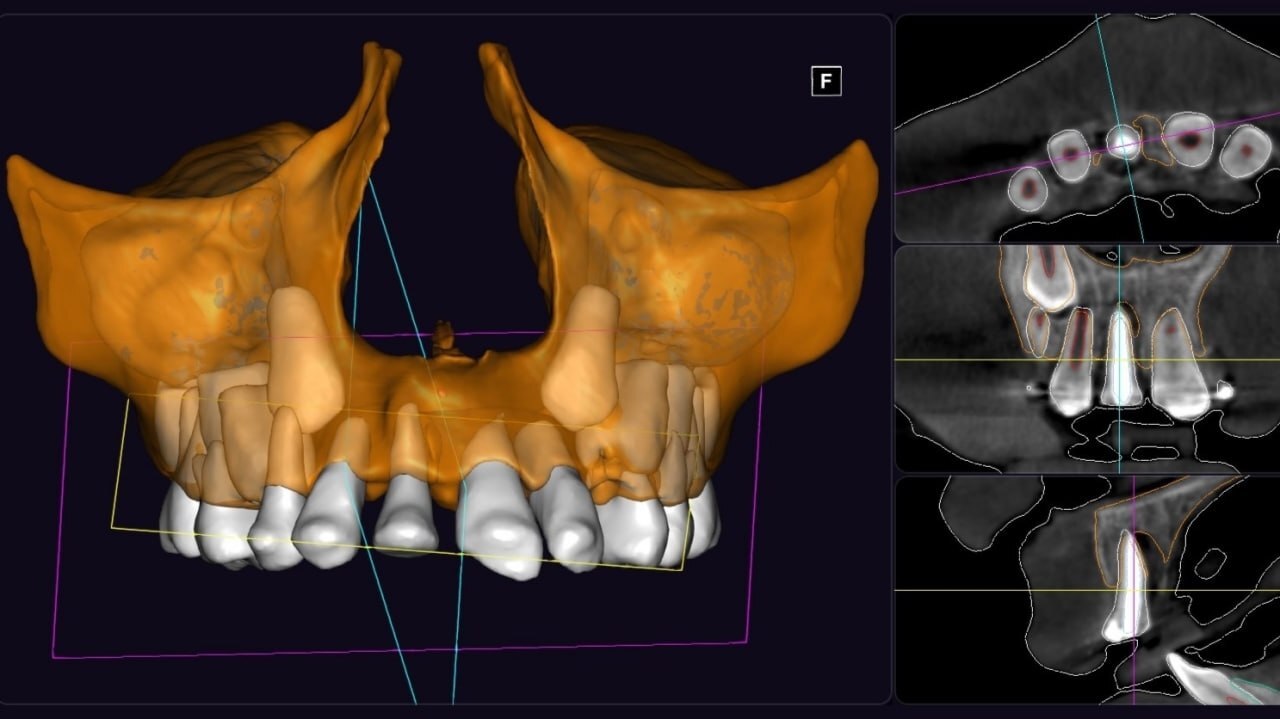 An 8-year-old female patient was referred by a colleague from St. Petersburg. - Dentistry, Teeth, Doctors, Health