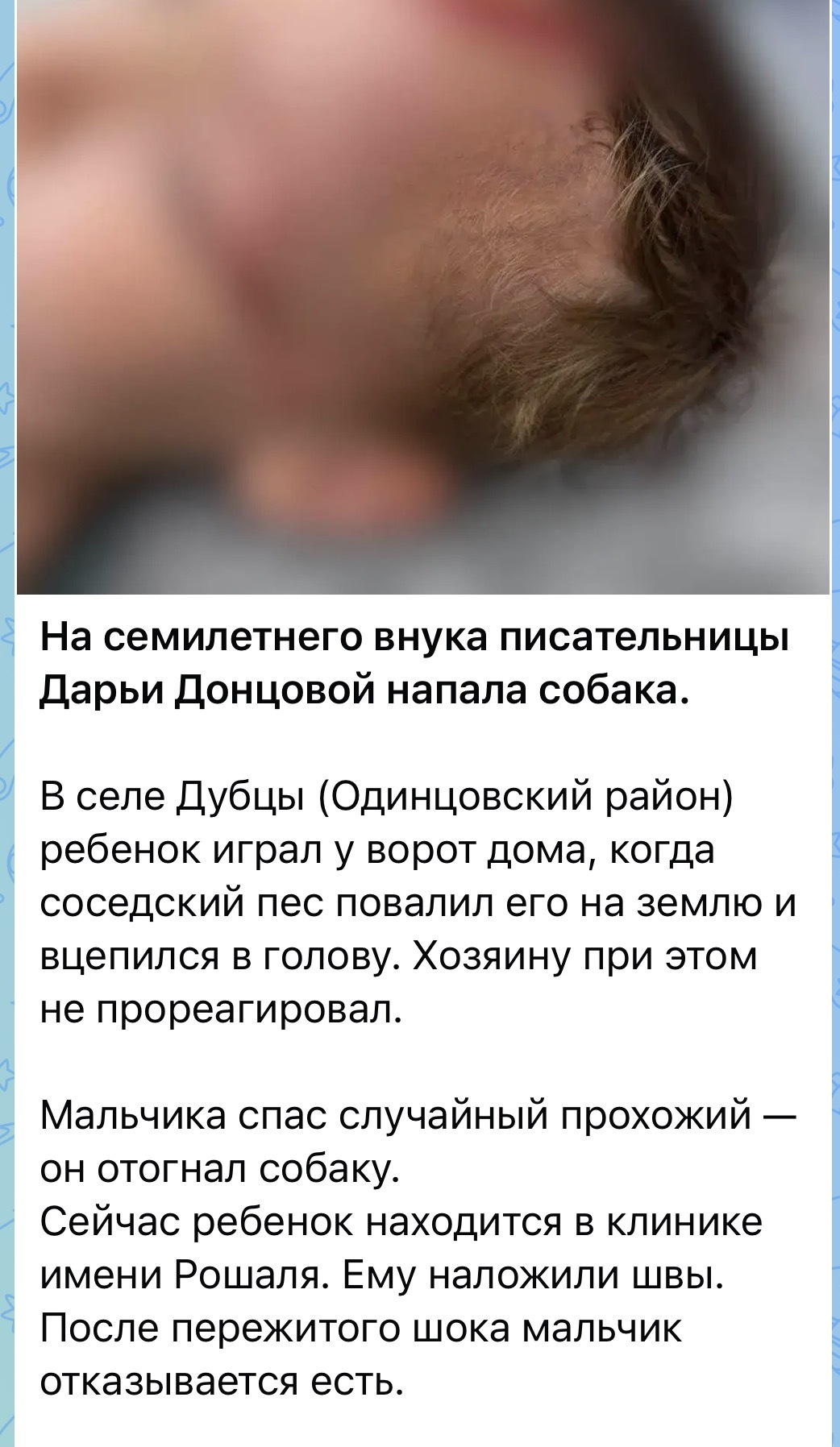 The dog attacked Dontsova's grandson - Radical animal protection, Dog attack, Dog, Negative