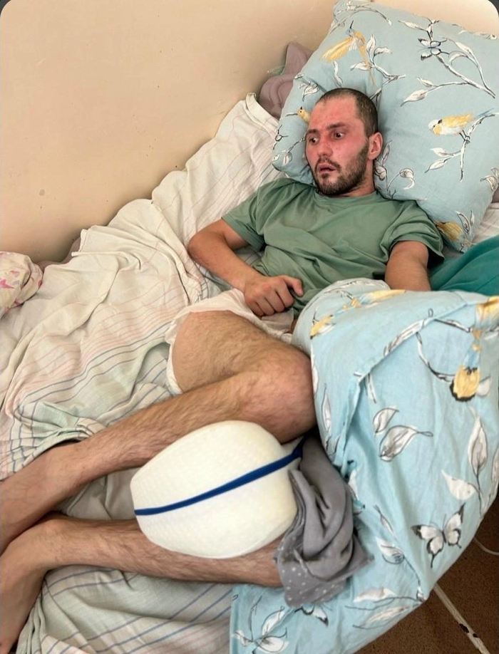 В таком состоянии Алексей находился в больнице Источник: Антонина Греф / <!--noindex--><a href="https://pikabu.ru/story/prevratili_v_ovoshch_za_sutki_kak_uralskiy_boets_svo_perezhil_komu_i_ostalsya_invalidom_posle_avarii_14241340?u=http%3A%2F%2FVk.com&t=Vk.com&h=d70e0d7fa10ed9b9c3be4e2d229185d3fbf20fb1" title="http://Vk.com" target="_blank" rel="nofollow noopener">Vk.com</a><!--/noindex-->